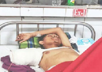 বৈষম্যবিরোধী ছাত্র আন্দোলনের সময় সংঘর্ষ-সহিংসতায় হাত–পা হারালেন ১৯ জন