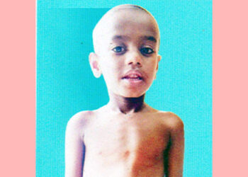 বাঁচতে চায় ৬ বছরের শিশু জিসান